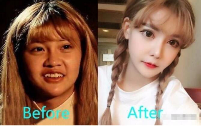 网红韩安冉旧照再被网友翻出，如今多次整容历史真容引人好奇！