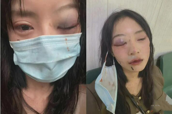 快手网红猪有蹄发文自曝被殴打！男方称对方“打气”怀孕！