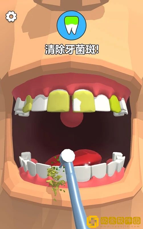 拔牙吗我贼6